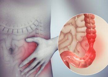 What is the Full Form of IBS? Want’s Causing IBS